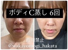 イチハチドット(18.)/ボディ蒸し☆６回