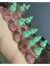 はりめぐり/吸玉