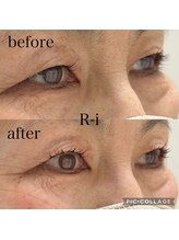 アールアイ(R-i)/アイリッドアップパーマ