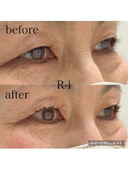 アールアイ(R-i)/アイリッドアップパーマ