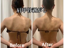 ラウーム 下北沢(lawomb)/肩甲骨剥がし