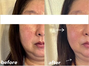 リラクゼーションエステ アジュール(Azur)/【施術12回】