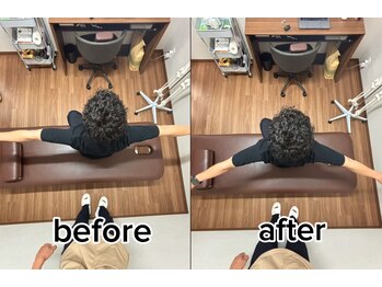 オン鍼灸整体院(ON鍼灸整体院)/整体&鍼灸/ビフォーアフター