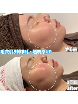 ビアル(VIALU)/肌の土台から美しく毛穴レス美肌