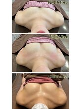 ロココ 豊田店(Rococo)/ビフォーアフター