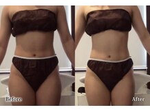 アネル 宮古島店(anel)/