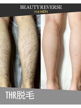 ビューティーリバース FORMEN 東戸塚店/メンズあし脱毛　THR方式脱毛