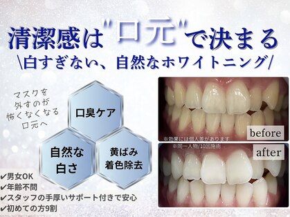 ホワイトニングショップ 福岡姪浜店の写真