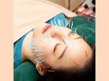 健志接骨院/大人気のマロン鍼でハリ艶肌ケア