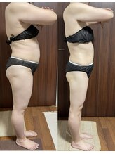 ヴィム(VIM)/ハイパーナイフビフォーアフター