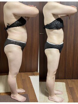 ヴィム(VIM)/ハイパーナイフビフォーアフター