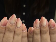 ミティネイル 北中城(mittynail)/ピーチネイル/定額デザイン