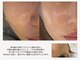 ボーテラボ 大宮(beaute LABO)の写真/うっかり浴びた紫外線の後悔もリセット！プロの手で角質を整え、触れたくなるツルツルな素肌に。