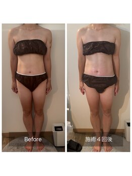 フィエルテ 甲斐敷島(FIERTE)/お客様 Before After