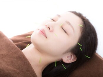 サロン ド グランツィア(salon de Granzia)の写真/「え！？嘘みたい！」な実感で大好評♪ 美容鍼で目元・頬のたるみを劇的リフトアップ◎若々しい印象に！