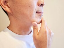 ティア ザ ビューティー(The beauty)