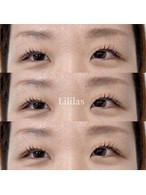 リリラース(Lililas)/