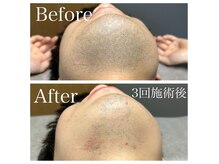 効果の出る施術を提供します！