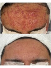 ハクビューティー(HAKU BEAUTY)/