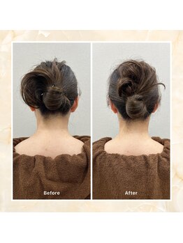 プレメ 人形町院(The Preme)/くびケアスリム 1回施術後