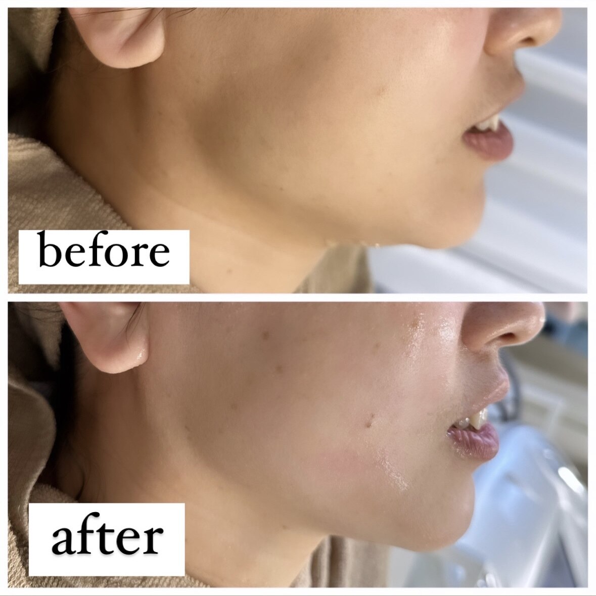 ティースタイル 赤坂(T style)｜ホットペッパービューティー