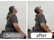 ナオル整体 大里院(NAORU整体)/女性　姿勢のビフォーアフター