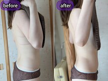 スノードロップ(snowdrop)/リンパマッサージ