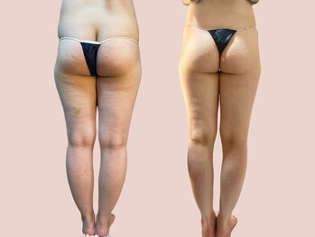 シェリートーキョー 成田店(Cherie Tokyo)/Before＆After /成田店