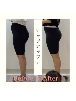 スタイルラボ高松/産後骨盤矯正の効果♪