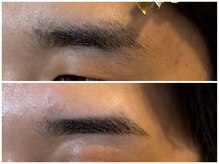 スリーピース(3Peace)/ストレート眉 Before/After