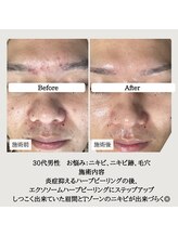 ル ボヌール 伊那店(le bonheur)/凸凹肌も・・・