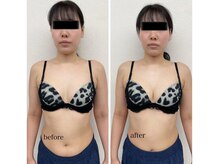 ルミエール(Lumiere)/【倉敷市】バストアップ施術事例