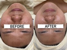 クレア(Claire)/クリスティーナ各種7回施術