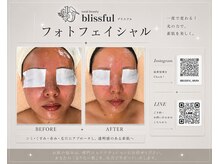 ブリスフル(Blissful)の雰囲気(★ビフォーアフター★)