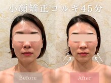 ドレッサー 福岡香椎店(DRESSER)の雰囲気（小顔矯正コルギで骨格と巡りを整え、小顔×美肌が同時に叶う＊*）