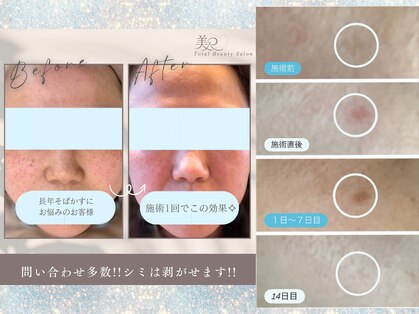 美Rの写真