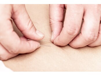 こころ鍼灸院/体質別妊活鍼灸を行っています！