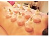 《代謝低下に》よもぎ蒸し×カッピングDETOX！肩甲骨ほぐし￥12950→9000