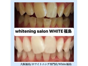 ホワイトニングサロン ホワイト(WHITE)/セルフホワイトニング/大阪/福島