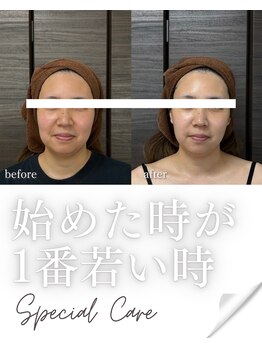 リノン(LIINON)/始めた時が1番若い時!