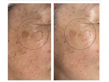 ペリドット(Peridot)/