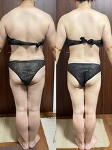 ヴィム(VIM)/ハイパーナイフビフォーアフター