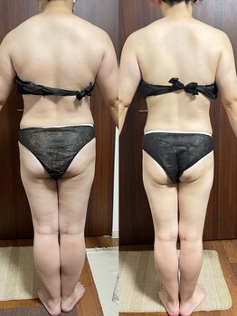 ヴィム(VIM)/ハイパーナイフビフォーアフター