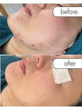 リノルーア(Linolua)/