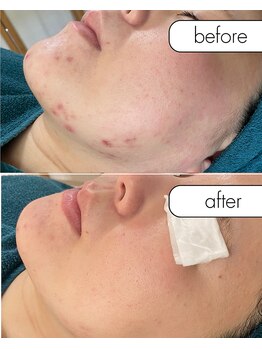 リノルーア(Linolua)/