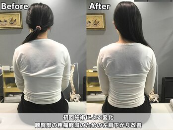 整体院 ワン(ONE)/初回施術による変化