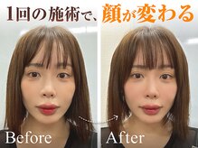 たんぽ美容整体 池袋店