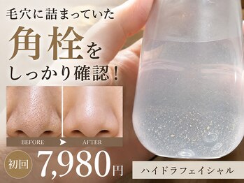 キューレット(CULET)の写真/毛穴の黒ずみ・角栓を徹底洗浄♪取れた汚れを目で確認!開いた毛穴は最後に必ず引き締め