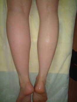 エイジングケアエステ ブルームーン(Blue moon)/リジュ・ボディメイキング：4-1