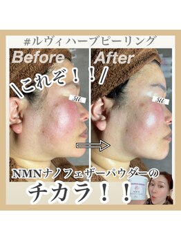 スー(su:)/NMNのパワーがすごい！